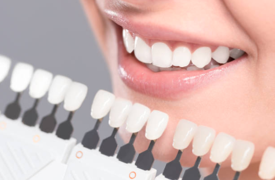 A preview of different levels of teeth whitening