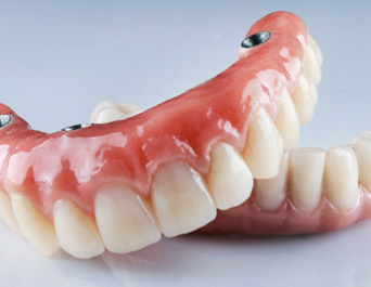 implant dentures