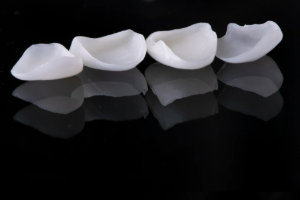 Four veneers sitting in a row on a black reflective surface